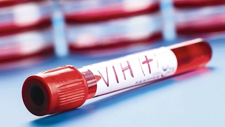 OMS brinda  informe alarmante de infecciones de VIH