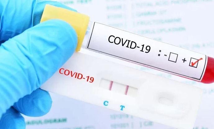 Médicos confirman nueva ola de COVID-19 en el país